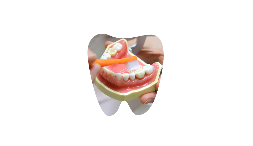 虫歯の予防と 再石化