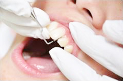 歯周組織検査